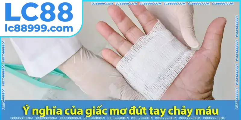 Ý nghĩa tâm linh của giấc mơ đứt tay chảy máu Ý nghĩa tâm linh của giấc mơ đứt tay chảy máu: Hình ảnh minh họa bàn tay bị đứt chảy máu đỏ